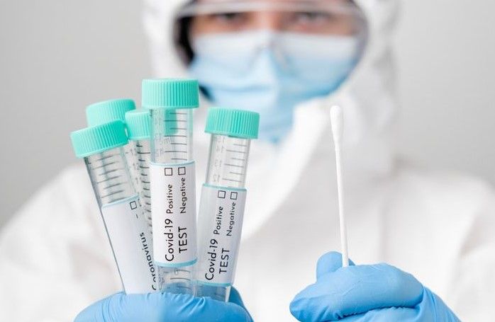 Jambi Masih Kekurangan Tiga Alat PCR