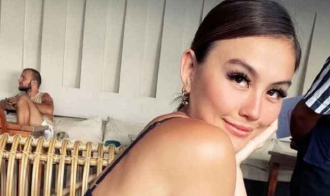 Ini Reaksi Agnez Mo Ditinggalkan Sang Dancer!