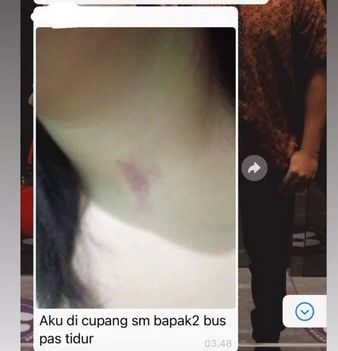 Viral Pelecehan Seksual dalam Bus: Sopir Remas Payudara dan Cupang Leher Penumpang