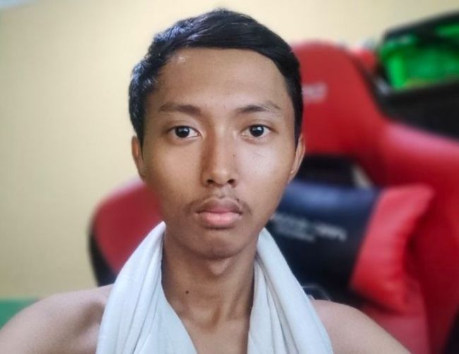 Wow! Foto Selfie Wajah Ndeso Ghozali Ghozalu Laku Miliaran Rupiah di Marketplace NFT