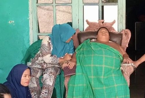 Bocah 11 Tahun Penderita Obesitas Seberat 126 Kilogram di Bekasi Meninggal