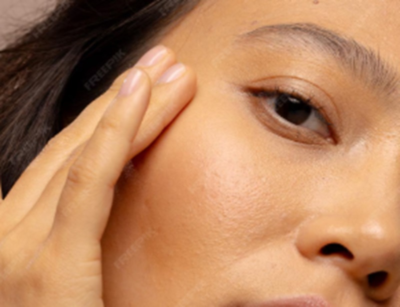 Kulit Mulai Kehilangan Elastisitas? Saatnya Rawat dari Dalam dengan Nutricoll B ERL