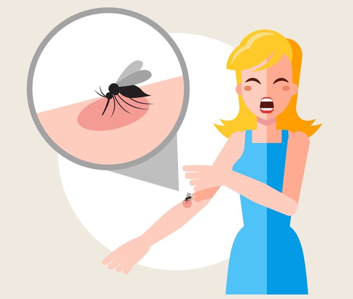 10 Tips Ampuh dan Alami Mengatasi Luka Akibat Gigitan Nyamuk