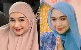 Ria Ricis Dihujat Usai Operasi Hidung, Tanggapi Kritikan dengan Santai