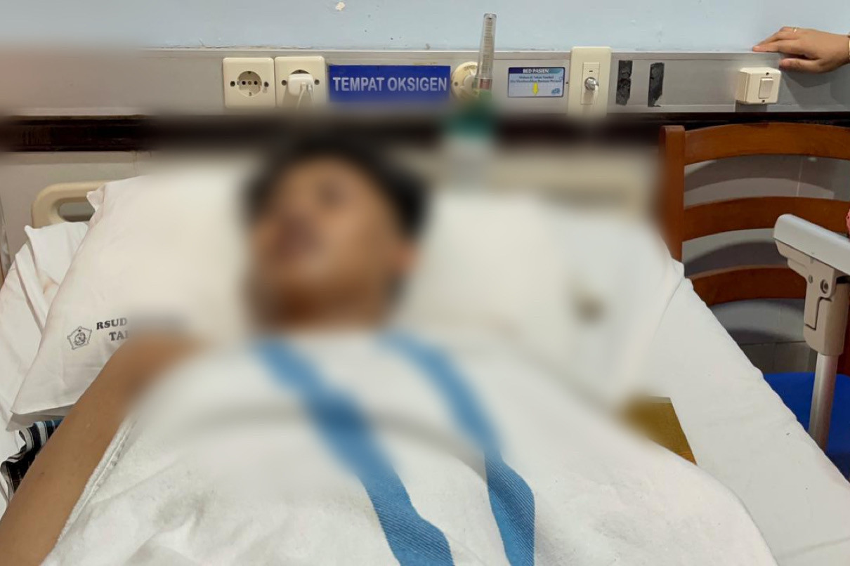 Tragedi Al Khoziny: Kisah Pilu Nur Ahmad, Santri yang Kehilangan Lengan