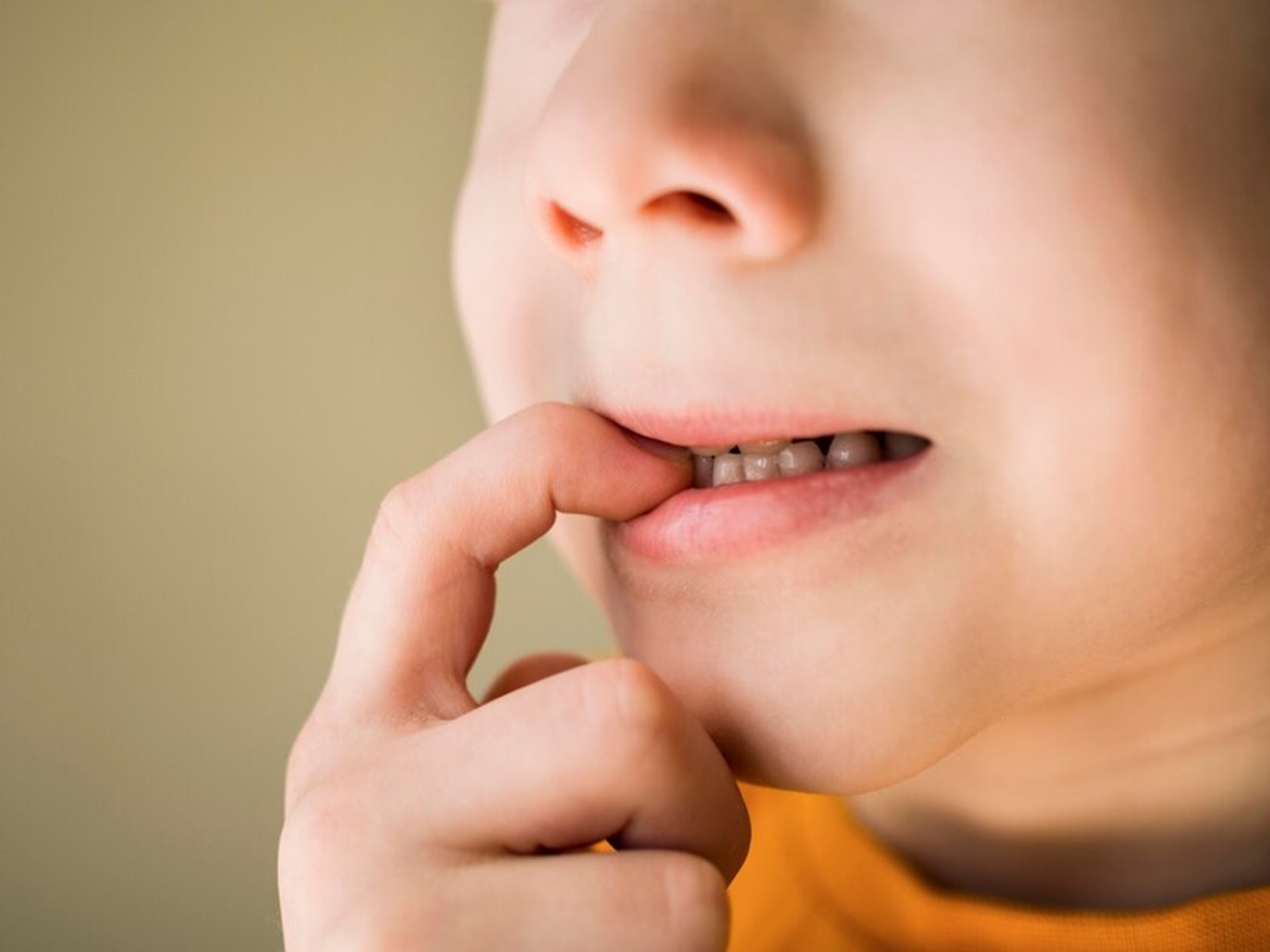 Cara Mengatasi Bibir Pecah-pecah Pada Anak