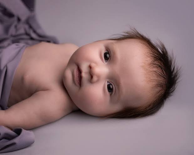 Kenapa Mata Bayi Belekan? Ini Penyebab dan Cara Mengatasinya