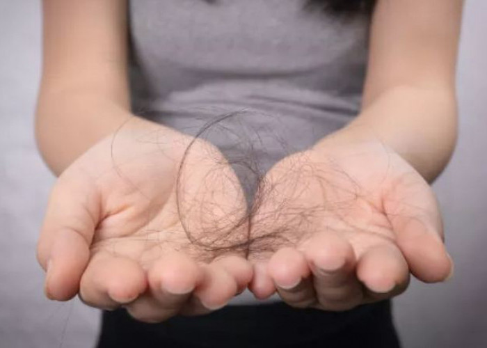 12 Tips Merawat Rambut Agar Tidak Mudah Rontok, Jangan Lakukan Hal-hal Ini!