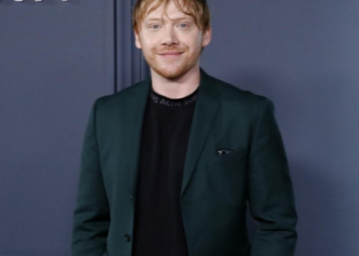 Pemeran Ron Weasley Di Film 'Harry Potter' Punya Utang Pajak Sebesar 36 Miliar