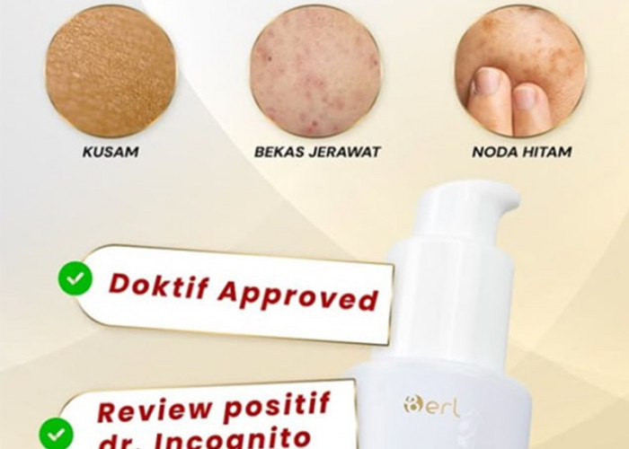 Kulit Kusam, Gampang Berminyak dan Mulai Muncul Garis Halus? Kulitmu Butuh Serum Booster Ini Sekarang!