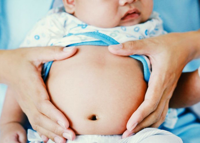 10 Tips Atasi Perut Kembung pada Bayi Secara Alami
