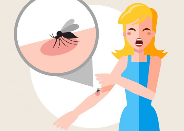 10 Tips Ampuh dan Alami Mengatasi Luka Akibat Gigitan Nyamuk