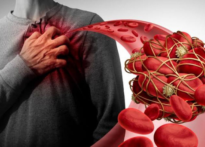 5 Makanan Pemicu Pengentalan Darah pada Perempuan 