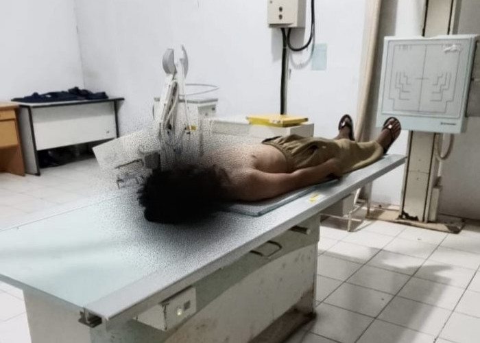 Anak Diduga Jadi Korban Pengeroyokan di Sekolah, Orang Tua Tempuh Jalur Hukum