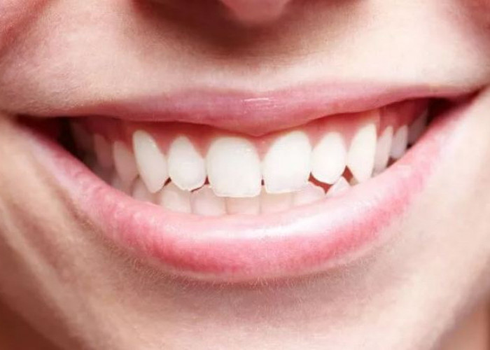 Cara Sederhana Mengurangi Karang Gigi, Diantaranya Gunakan Benang