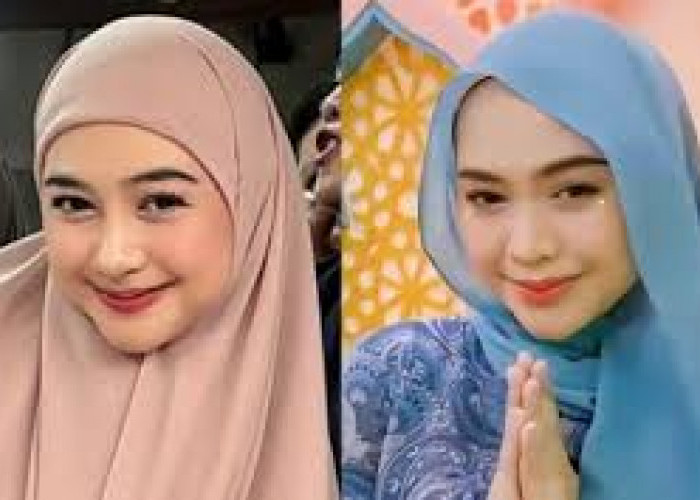 Ria Ricis Dihujat Usai Operasi Hidung, Tanggapi Kritikan dengan Santai