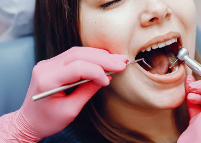 Cara Mudah Merawat Gigi Tanpa Harus ke Dokter