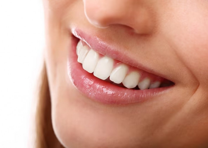 8 Tips Menjaga Kesehatan Gigi dan Mengurangi Karang Gigi