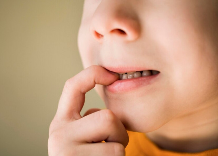 Tips Mengatasi Bibir Pecah-pecah pada Anak