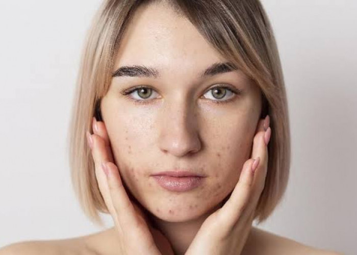 Bikin Kulit Gagal Glowing, Ini 7 Kesalahan saat Memakai Skincare