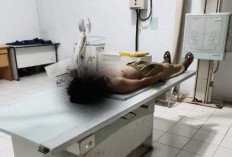 Anak Diduga Jadi Korban Pengeroyokan di Sekolah, Orang Tua Tempuh Jalur Hukum
