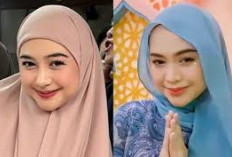 Ria Ricis Dihujat Usai Operasi Hidung, Tanggapi Kritikan dengan Santai